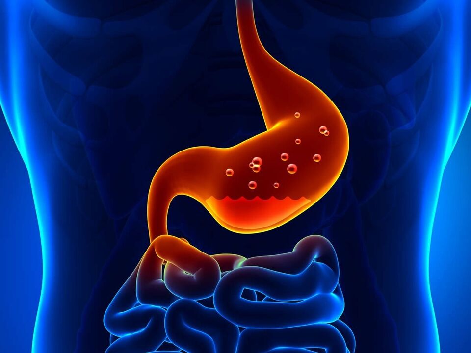 Gastritis is an inflammatory disease of the stomach and requires a diet